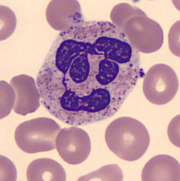 Interesting shape cells - Face 1
