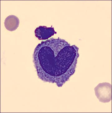 Interesting shape cells - Heart